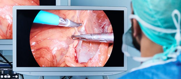 Curso Colecistectomia Laparoscópica Difícil (00008)