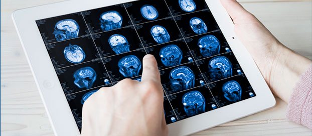 Internado Virtual: Neurocirugía Modalidad Online (00020)